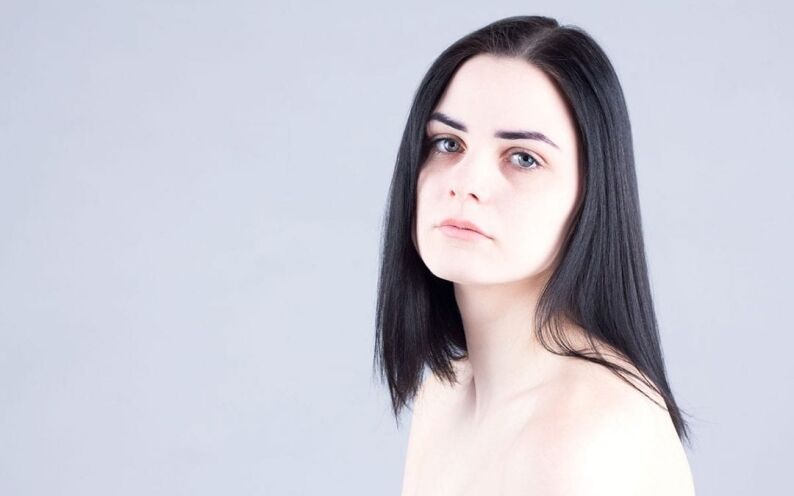 Under eye Filler Toronto