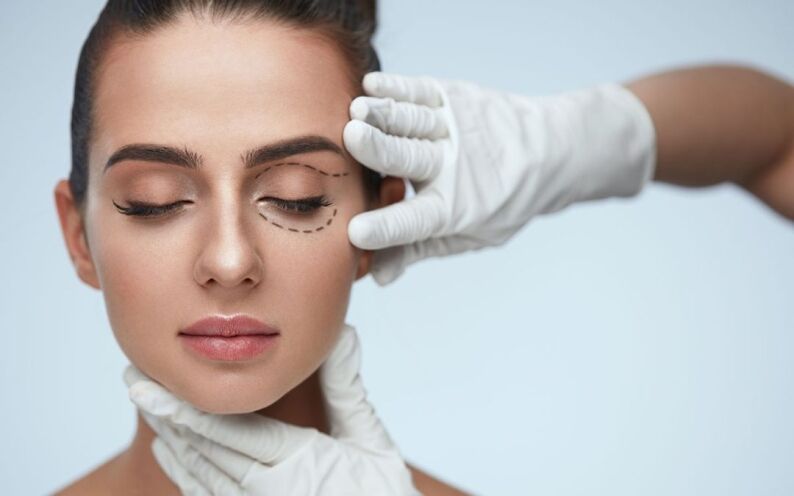 OHIP Eyelid Surgery in Toronto