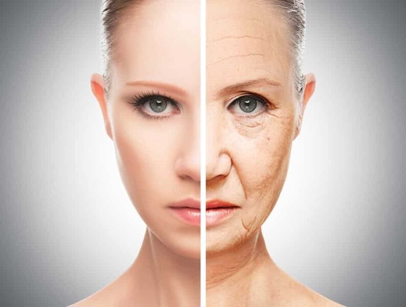 Facelift Surgery Wrinkle Free Face