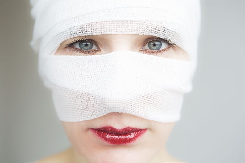 Facelift Toronto Recovery