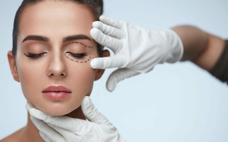 Eyelid Surgery Toronto