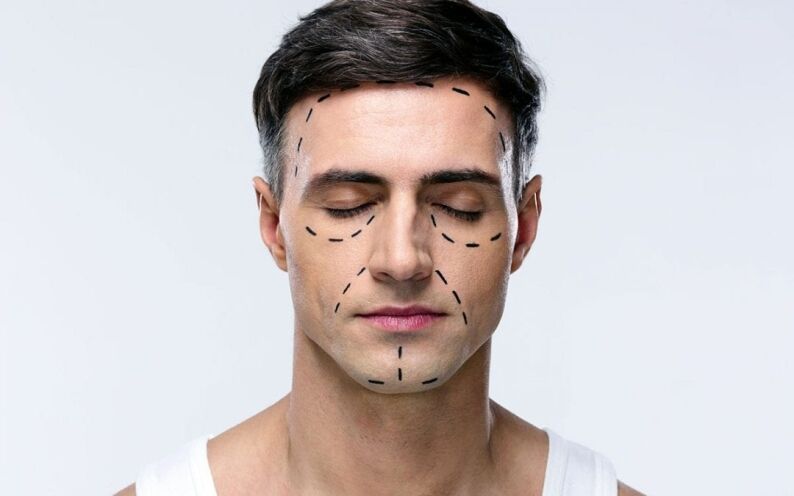 Plastic Surgery Toronto 3