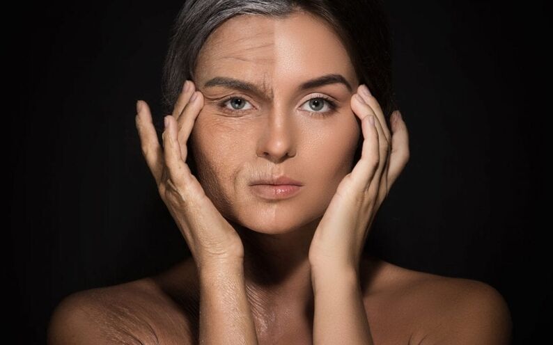 Facelift 2