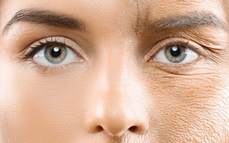 Facelift Before and After