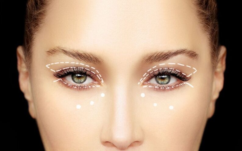 Blepharoplasty Toronto in 2022