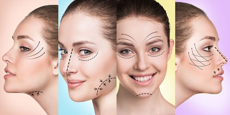 Facelift Toronto
